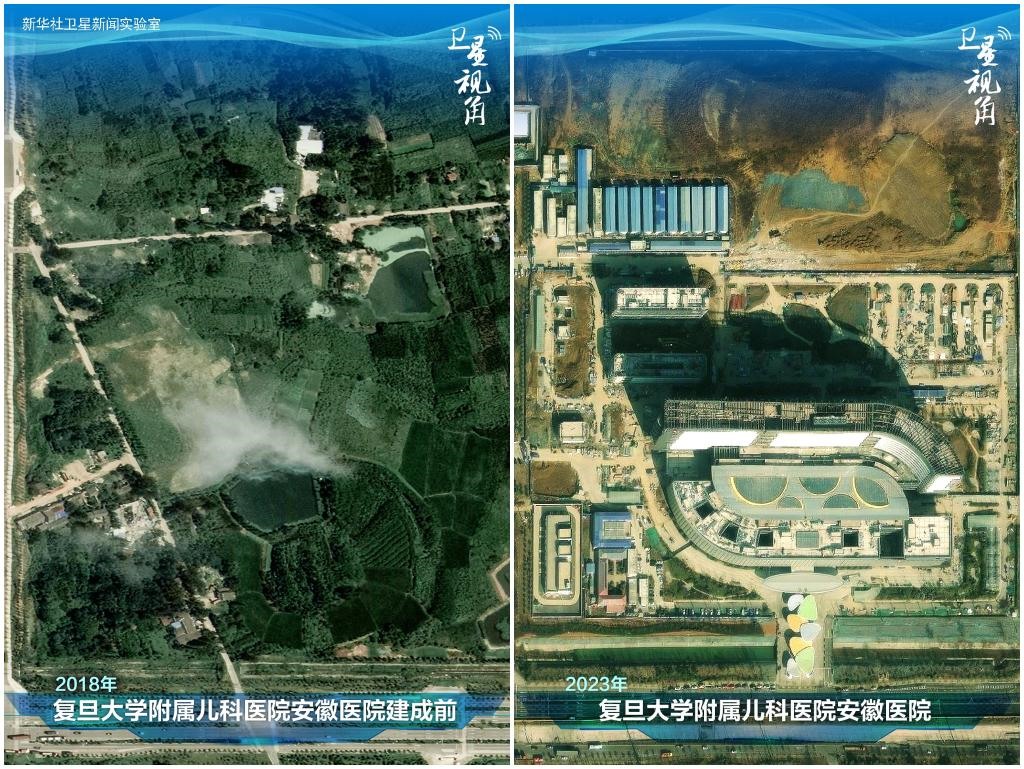 2023年與2018年相比，復(fù)旦大學(xué)附屬兒科醫(yī)院安徽醫(yī)院從一片荒地到建成投用。該項(xiàng)目是安徽省在長三角一體化高質(zhì)量發(fā)展衛(wèi)生健康領(lǐng)域的重大項(xiàng)目，也是安徽首批落地的國家區(qū)域醫(yī)療中心。